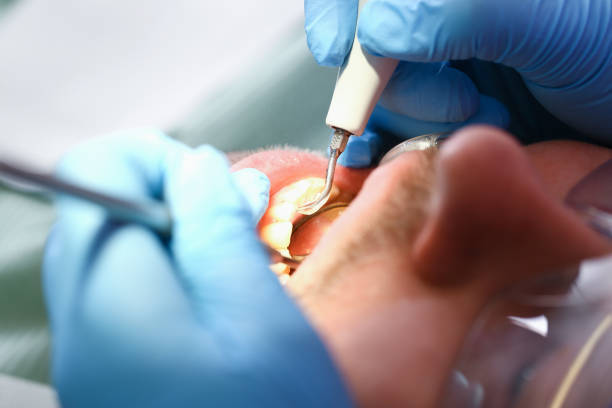 Best Emergency Dental Care for Broken or Chipped Teeth in Marshall, WI
