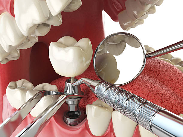Best Emergency TMJ Treatment in Marshall, WI